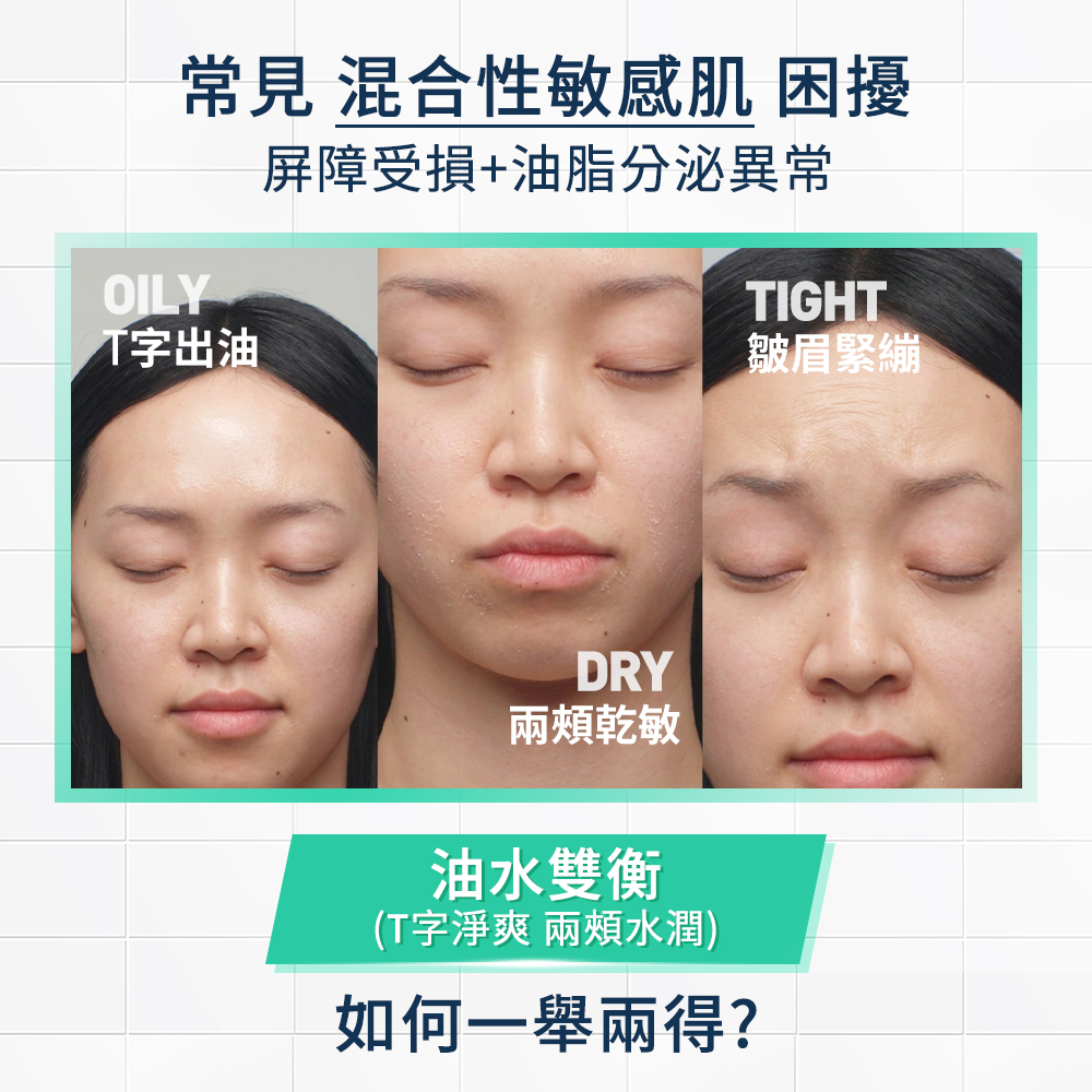 混合性敏感肌常T字出油、兩頰乾敏、皺眉緊繃