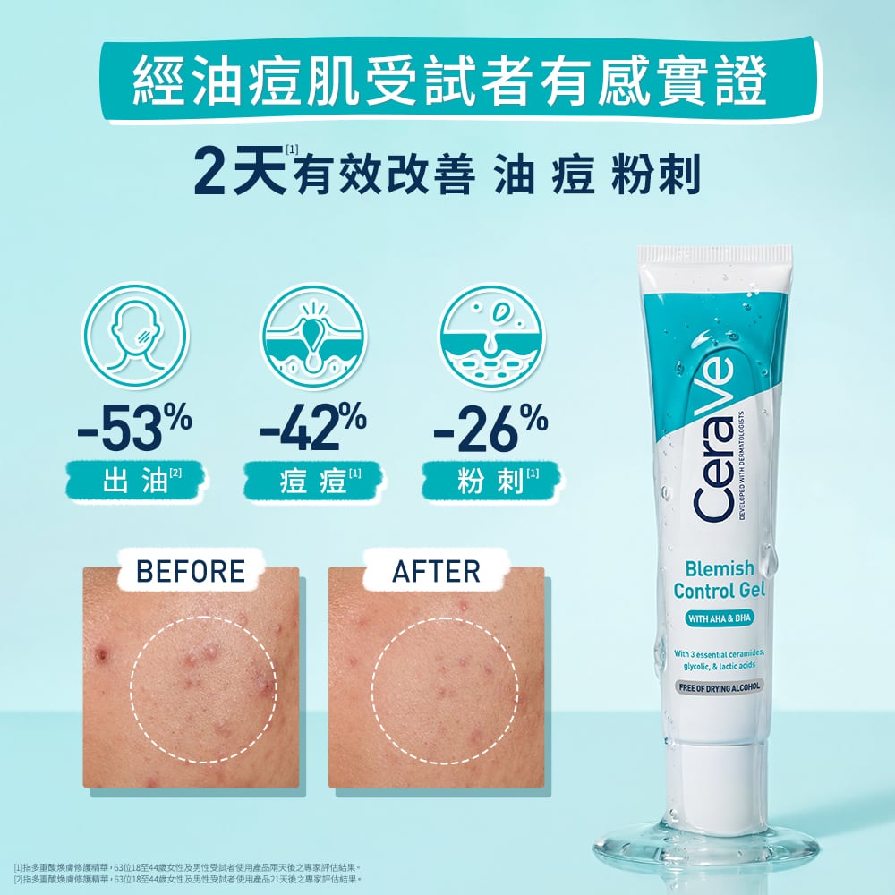 經油痘肌受試者有感實證，2天有效改善油痘粉刺